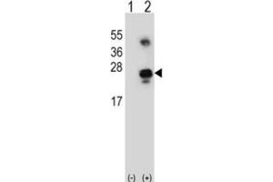 Western Blotting (WB) image for anti-Growth Arrest and DNA-Damage-Inducible, alpha (GADD45A) antibody (ABIN3001630)