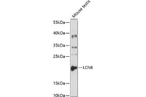 Western blot analysis of extracts of mouse testis, using LCN6 antibody (ABIN3021714, ABIN3021715, ABIN3021716 and ABIN6215606) at 1:1000 dilution.