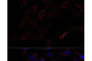 Immunofluorescence analysis of C6 cells using SEPT8 Polyclonal Antibody at dilution of 1:100. (Septin 8 anticorps)