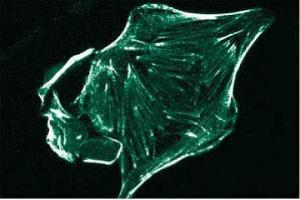 Immunofluorescence staining of HS 766T cells (Human pancreatic carcinoma, ATCC HTB-134). (Ron alpha (AA 40-224) anticorps)