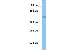 WB Suggested Anti-VANGL1 Antibody Titration: 1. (Vangl1 anticorps  (N-Term))