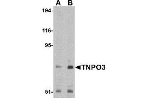 Western Blotting (WB) image for anti-Transportin 3 (TNPO3) (N-Term) antibody (ABIN1031633) (Transportin 3 anticorps  (N-Term))