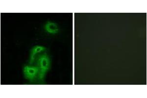 Immunofluorescence analysis of A549 cells, using 5-HT-2A Antibody.