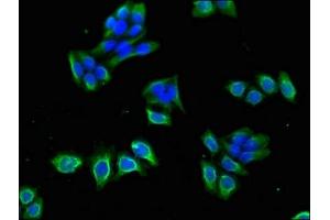 Immunofluorescent analysis of PC-3 cells using ABIN7175600 at dilution of 1:100 and Alexa Fluor 488-congugated AffiniPure Goat Anti-Rabbit IgG(H+L)