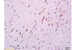 Formalin-fixed and paraffin embedded rat brain labeled with Anti DARPP32 Polyclonal Antibody, Unconjugated (ABIN680323) at 1:200 followed by conjugation to the secondary antibody and DAB staining