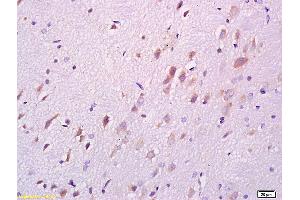 Formalin-fixed and paraffin embedded rat brain labeled with Anti DARPP32 Polyclonal Antibody, Unconjugated (ABIN680323) at 1:200 followed by conjugation to the secondary antibody and DAB staining (DARPP32 anticorps  (AA 51-150))