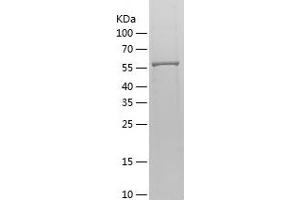 Western Blotting (WB) image for Adenylate Kinase 5 (AK5) (AA 1-562) protein (His-IF2DI Tag) (ABIN7121721)