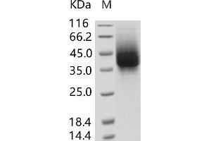 Western Blotting (WB) image for Respiratory Syncytial Virus Glycoprotein (RSV G) protein (His tag) (ABIN7198761)