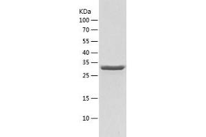 Western Blotting (WB) image for UBX Domain Protein 2B (UBXN2B) (AA 1-331) protein (His-IF2DI Tag) (ABIN7125645)