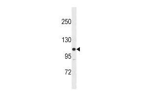 Western blot analysis in SK-BR-3 cell line lysates (35ug/lane).