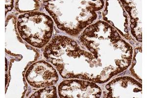 ABIN6274306 at 1/100 staining Human kidney tissue by IHC-P. (Retinol Binding Protein 5 anticorps)