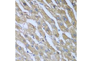 Immunohistochemistry of paraffin-embedded human liver using CAD antibody at dilution of 1:100 (40x lens). (CAD anticorps)