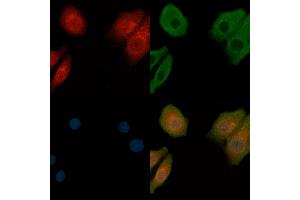 ABIN6257047 and ABIN6273668 staining Hela cells by IF/ICC. (Integrin alpha 1 anticorps  (Internal Region))