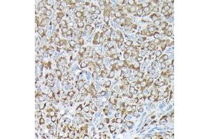 Immunohistochemistry of paraffin-embedded rat ovary using RPS15A Rabbit pAb (ABIN6131092, ABIN6147201, ABIN6147202 and ABIN6214414) at dilution of 1:200 (40x lens). (RPS15A anticorps  (AA 1-130))