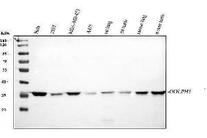 Western blot analysis of GOLPH3 using anti-GOLPH3 antibody (ABIN6719570).