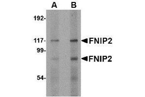 Western blot analysis of FNIP2 in rat skeletal muscle lysate with AP30345PU-N FNIP2 antibody at (A) 1 and (B) 2 μg/ml. (FNIP2 anticorps  (C-Term))