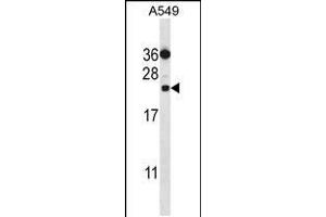 Western blot analysis in A549 cell line lysates (35ug/lane).