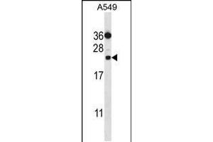 Western blot analysis in A549 cell line lysates (35ug/lane). (PSMD10 anticorps  (C-Term))