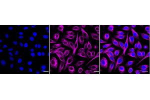 Immunocytochemical staining of HepG2 cells with Pannexin 1 antibody (ABIN7799733), 1:1,000). (Recombinant PANX1 anticorps)