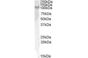 Anti-IL17ra (1µg/ml) staining of Rat Kidney lysate (35µg protein in RIPA buffer). (IL17RA anticorps  (Internal Region))