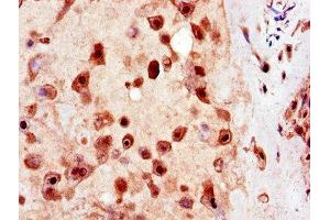Immunohistochemistry of paraffin-embedded human placenta tissue using ABIN7174296 at dilution of 1:100 (USP25 anticorps  (C-Term))