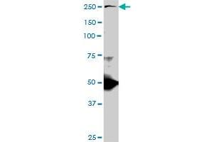 TLN1 monoclonal antibody (M06), clone 2E10. (TLN1 anticorps  (AA 1052-1149))