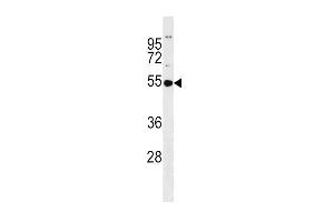 GSS Antibody (C-term) (ABIN390882 and ABIN2841094) western blot analysis in MDA-M cell line lysates (35 μg/lane).