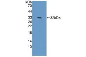 Detection of Recombinant BAFF, Mouse using Polyclonal Antibody to B-Cell Activating Factor (BAFF) (BAFF anticorps  (AA 68-283))