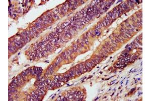 anti-Chemokine (C-X-C Motif) Receptor 3 (CXCR3) (AA 4-50) antibody