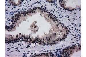 Image no. 7 for anti-Bridging Integrator 3 (BIN3) antibody (ABIN1496923)