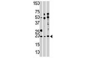 Western blot analysis of RPL23A polyclonal antibody , from left to right, CEM, Hela, and HepG2 cell line lysates (35 ug/lane). (RPL23A anticorps  (C-Term))