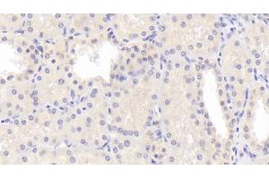 Detection of LPCAT1 in Human Kidney Tissue using Polyclonal Antibody to Lysophosphatidylcholine Acyltransferase 1 (LPCAT1) (LPCAT1 anticorps  (AA 70-237))