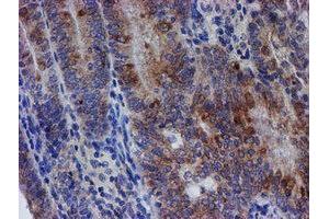 Image no. 6 for anti-Chromosome 21 Open Reading Frame 56 (C21orf56) antibody (ABIN1497041) (C21ORF56 anticorps)