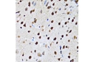 Immunohistochemistry of paraffin-embedded rat brain using CC antibody (ABIN6133528, ABIN6138034, ABIN6138035 and ABIN6222941) at dilution of 1:100 (40x lens). (CCAR2 anticorps  (AA 654-923))