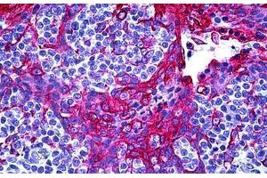 Human Tonsil, Squamous Epithelium: Formalin-Fixed, Paraffin-Embedded (FFPE)