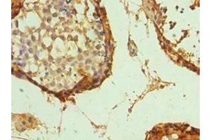 Immunohistochemistry of paraffin-embedded human testis tissue using ABIN7172390 at dilution of 1:100
