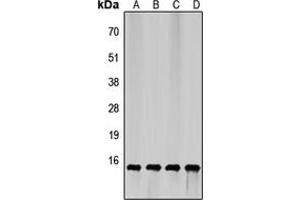 Western blot analysis of 4EBP1 expression in HEK293T (A), HepG2 (B), mouse brain (C), rat liver (D) whole cell lysates. (eIF4EBP1 anticorps  (N-Term))