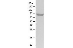 Western Blotting (WB) image for Ubiquilin 2 (UBQLN2) (AA 1-624) protein (His tag) (ABIN7125571)