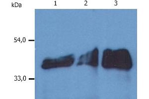 Western Blotting analysis (reducing conditions) of whole cell lysate using anti-human Cytokeratin 18 (DA-7). (Cytokeratin 18 anticorps  (Biotin))