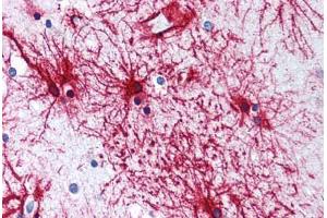 Human Brain, Cortex, Astrocytes (formalin-fixed, paraffin-embedded) stained with GFAP antibody ABIN305893 at 5 ug/ml followed by biotinylated anti-goat IgG secondary antibody ABIN481715, alkaline phosphatase-streptavidin and chromogen. (GFAP anticorps  (AA 417-430))