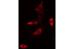 ABIN6268761 staining HUVEC cells by IF/ICC.