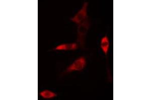 ABIN6268761 staining HUVEC cells by IF/ICC. (Claudin 6 anticorps  (Internal Region))