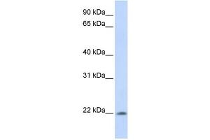 Western Blotting (WB) image for anti-All-Trans Retinoic Acid-Induced Differentiation Factor (ATRAID) antibody (ABIN2457891)