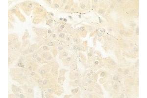 anti-POU Domain, Class 5, Transcription Factor 2 (POU5F2) (Internal Region) antibody