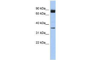 WB Suggested Anti-MGC48628 Antibody Titration: 0.