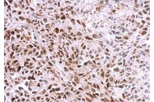 IHC-P Image SAMHD1 antibody [N2C2], Internal detects SAMHD1 protein at nucleus on SkHep1 xenograft by immunohistochemical analysis.