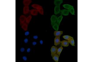 ABIN6262807 and ABIN6278585 staining Hela cells(24h of starvation treatment) by IF/ICC. (KIF20A anticorps  (C-Term))