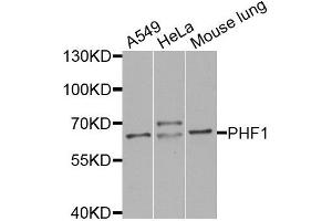 Western blot analysis of extracts of various cell lines, using PHF1 antibody (ABIN5974685) at 1/1000 dilution. (PHF1 anticorps)