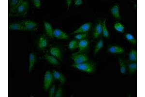 Immunofluorescence staining of Hela cells with ABIN7159545 at 1:133, counter-stained with DAPI. (MT3 anticorps  (AA 1-68))