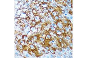Immunohistochemistry of paraffin-embedded Human esophageal using RCE1 Rabbit pAb (ABIN7265987) at dilution of 1:100 (40x lens). (RCE1/FACE2 anticorps)